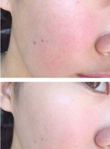 兰蔻、迪奥、香奈儿、YSL和阿玛尼的气垫BB有何不同?哪个好用? 兰蔻、迪奥、香奈儿、YSL和阿玛尼的气垫BB有何不同?哪个好用?