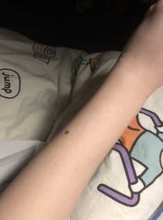 韩国Ulike激光脱毛仪是一款怎样的产品?好用吗? 韩国Ulike激光脱毛仪是一款怎样的产品?好用吗?