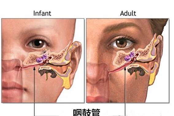 邦耳适中耳负压治疗仪 邦耳适中耳负压治疗仪