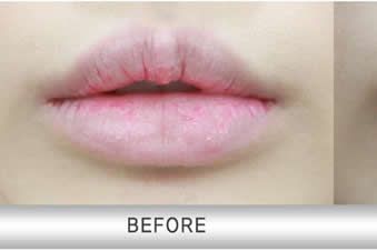 纹唇发黑原因及解决方法,纹绣新人最容易犯第4条 纹唇发黑原因及解决方法,纹绣新人最容易犯第4条