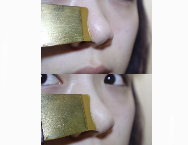 毛孔清洁器有用吗？什么毛孔清洁器好用？
