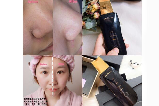 the beautools rocklean日本毛孔清洁器有用吗?有什么作用? the beautools rocklean日本毛孔清洁器有用吗?有什么作用?