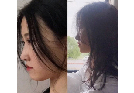 乔雅登玻尿酸怎么分别大中小分子的？