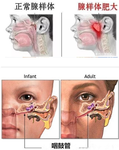 耳朵突然疼是怎么回事?这些细节不能大意! 耳朵突然疼是怎么回事?这些细节不能大意!