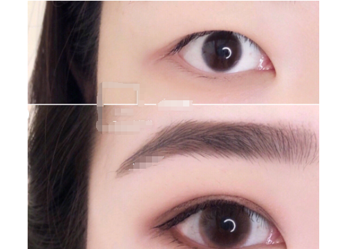 双眼皮贴怎么贴？双眼皮贴怎么撕掉呢？