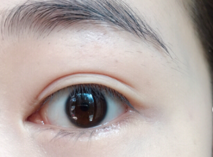 肿眼泡怎么选择双眼皮贴？使用方法呢？
