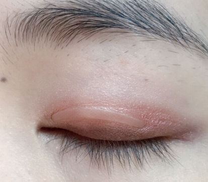 肿眼泡怎么选择双眼皮贴？使用方法呢？