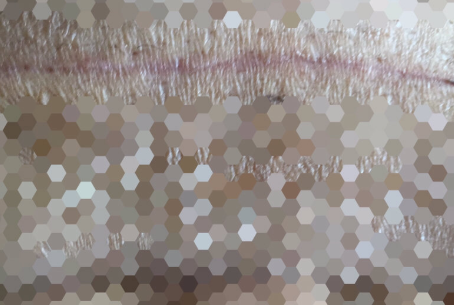 美皮护疤痕贴有用吗?效果怎么样? 美皮护疤痕贴有用吗?效果怎么样?