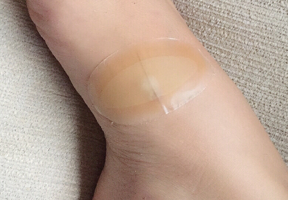 band aid创可贴如何？还有其他用处吗？