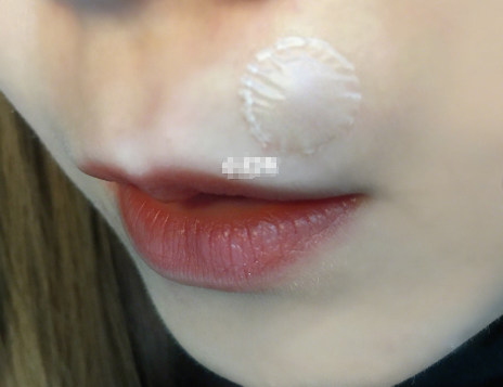 护妍天使隐形净痘贴有效果吗?使用感受怎么样? 护妍天使隐形净痘贴有效果吗?使用感受怎么样?