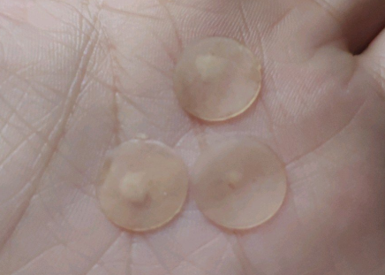 3m痘痘贴有用吗？效果好吗？