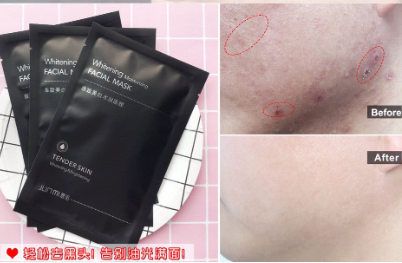 君觅怎么样?君觅男士面膜好用吗? 君觅怎么样?君觅男士面膜好用吗?