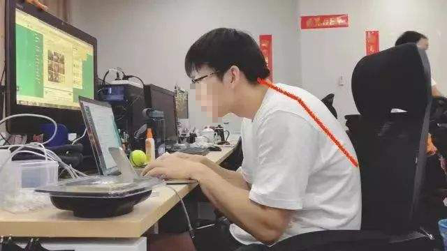 智能驼背监测提醒 