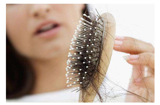防脱发洗发水有用吗 怎么样预防防脱发