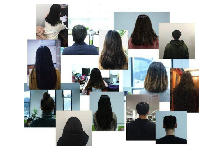 防脱发洗发水有用吗 怎么样预防防脱发 防脱发洗发水有用吗 怎么样预防防脱发