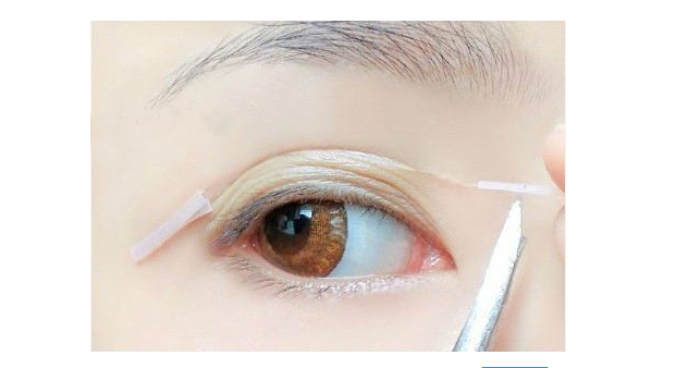 双眼皮贴贴久了有害吗 双眼皮贴的正确贴法 双眼皮贴贴久了有害吗 双眼皮贴的正确贴法