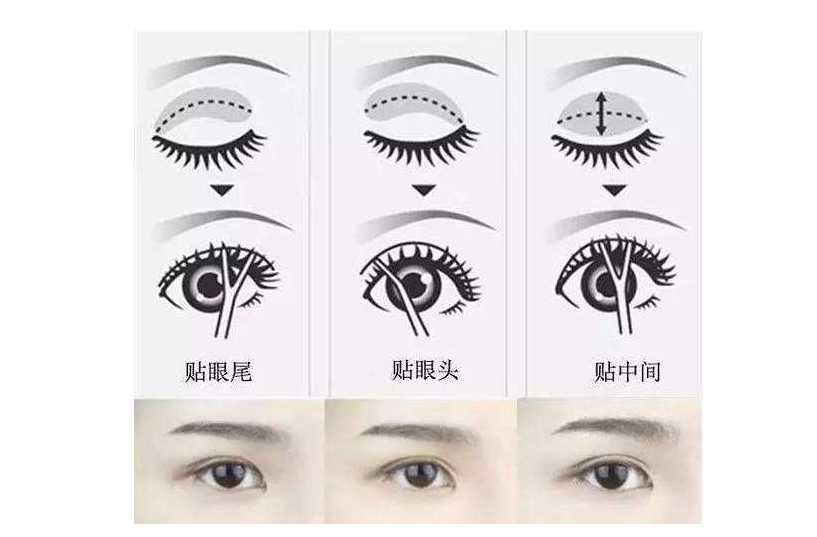 双眼皮贴贴久了有害吗 双眼皮贴的正确贴法 双眼皮贴贴久了有害吗 双眼皮贴的正确贴法