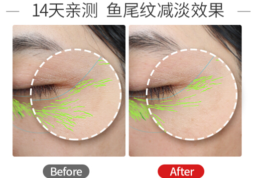 美容仪选的好 保持年轻容颜不是梦 美容仪选的好 保持年轻容颜不是梦