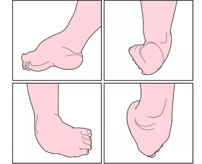 宝宝学步鞋怎么挑选 宝宝学步鞋选购攻略 宝宝学步鞋怎么挑选 宝宝学步鞋选购攻略