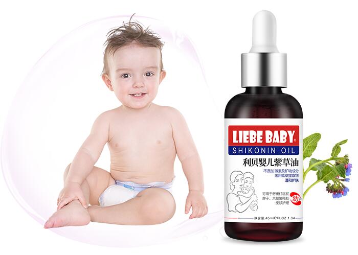 紫草油可以给婴儿用吗 紫草油的功效及使用注意事项 紫草油可以给婴儿用吗 紫草油的功效及使用注意事项