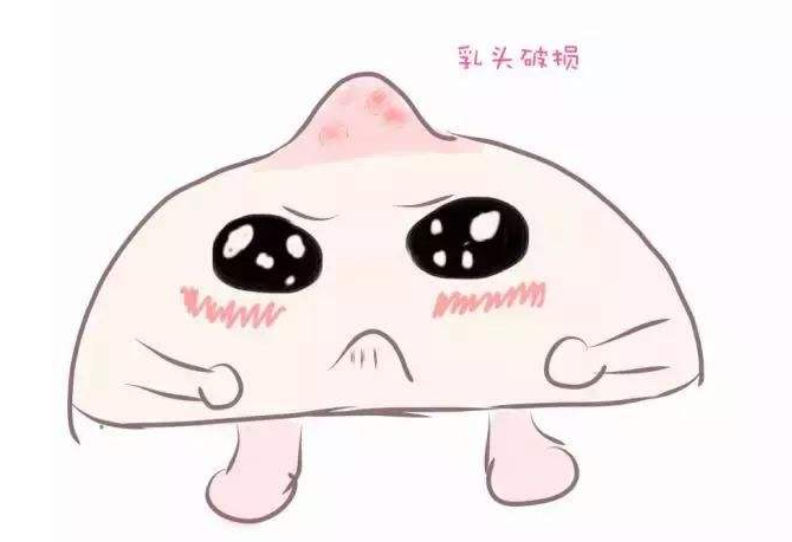 哺乳更轻松 乳头保护罩的那些小知识