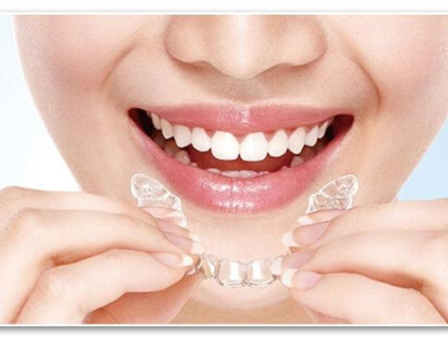 牙套有哪些类型 牙套使用要注意什么 牙套有哪些类型 牙套使用要注意什么