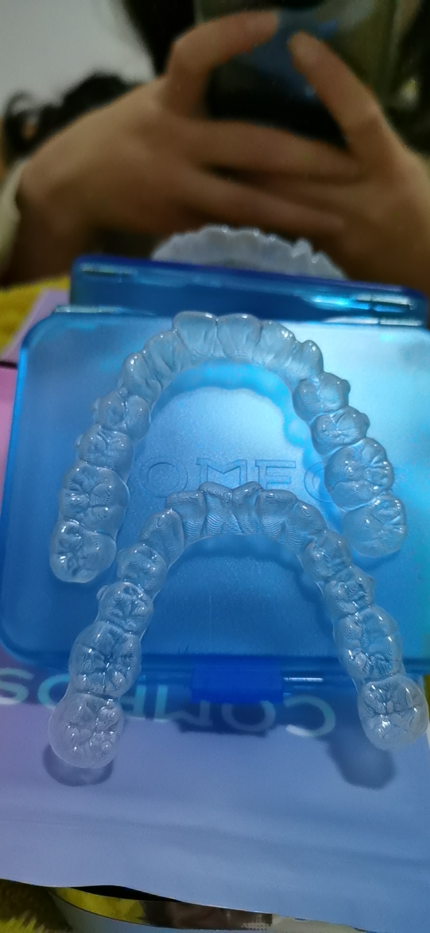 考虑再三,终于鼓起勇气来整牙了 考虑再三,终于鼓起勇气来整牙了